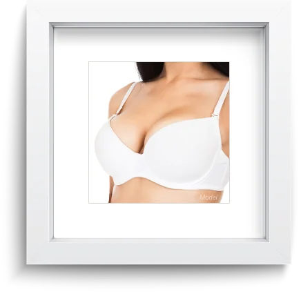 Breast Surgery Before and After Photo Gallery Richmond Virginia VA